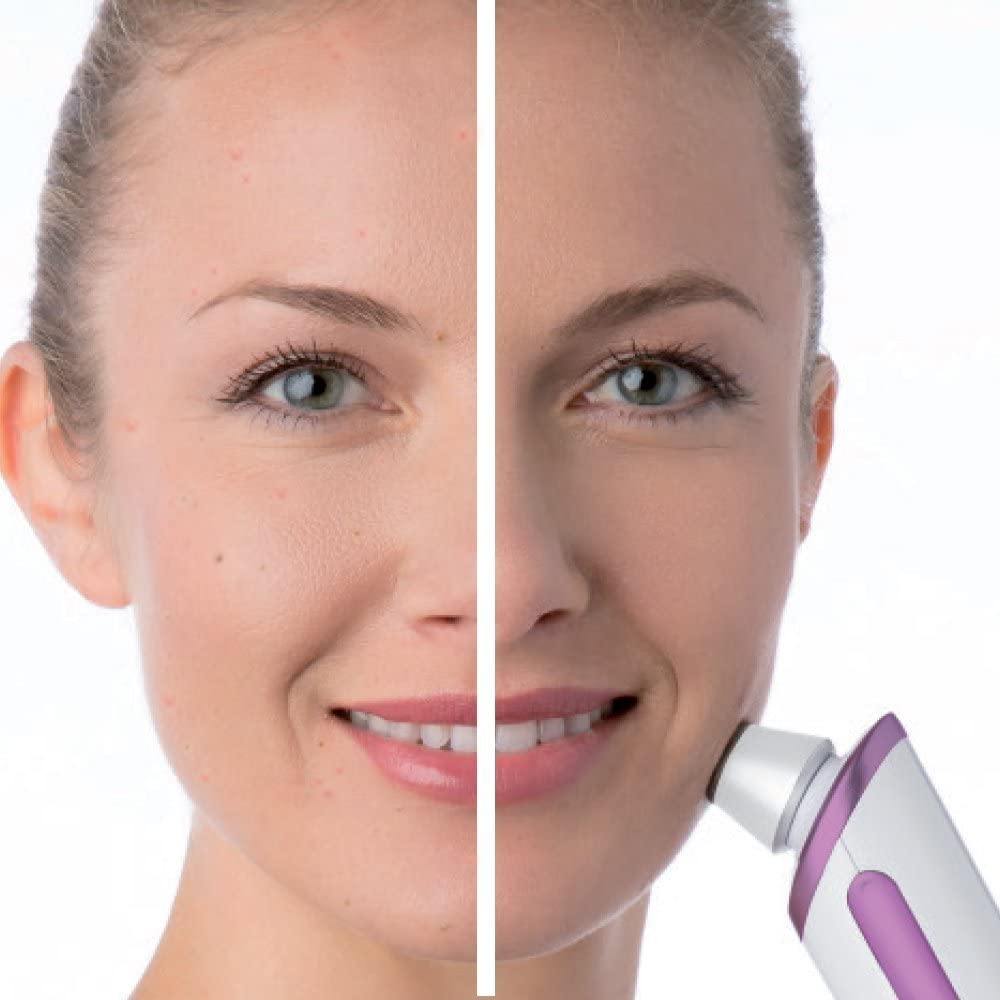beurer-fc-76-microdermoabrasi-n-facial-con-3-accesorios-de-zafiro-doble-efecto-p image 2