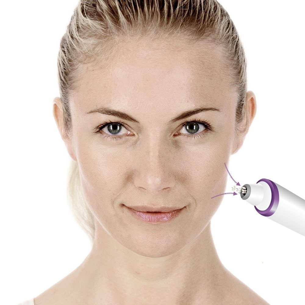 beurer-fc-76-microdermoabrasi-n-facial-con-3-accesorios-de-zafiro-doble-efecto-p image 5