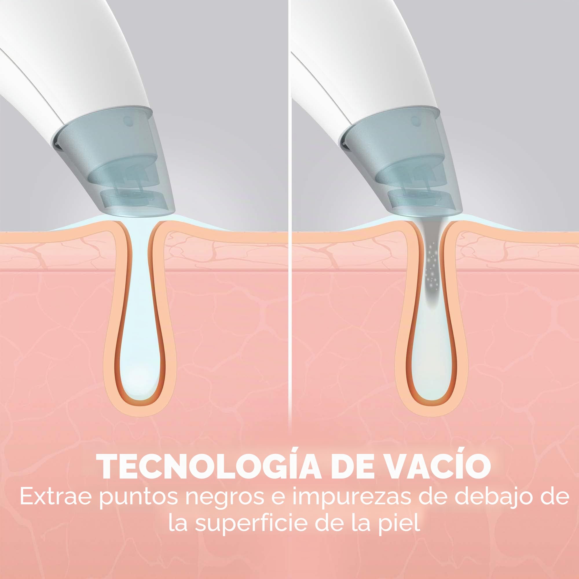 homedics-refresh-limpiador-de-hidrodermoabrasi-n-facial-removedor-de-puntos-negr image 4